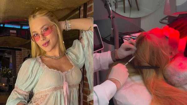 Virginia Fonseca volta a apresentar alopecia aerata: 'Pouquinho estresse'