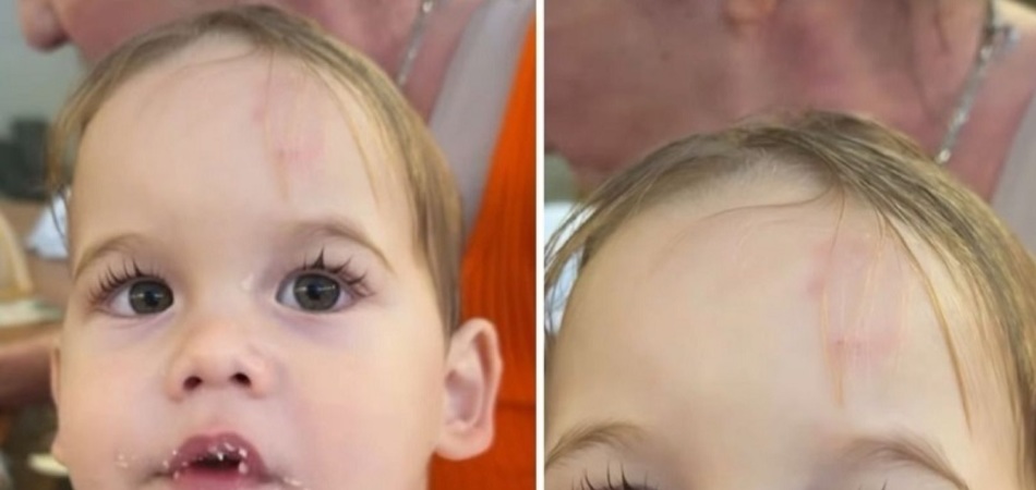 Virginia revela que o filho levou mordida na testa na escola