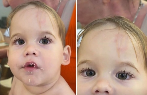 Virginia revela que o filho levou mordida na testa na escola