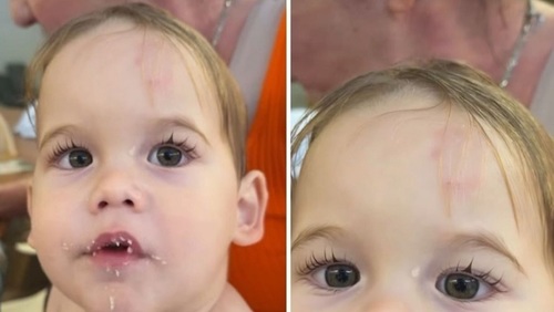 Virginia revela que o filho levou mordida na testa na escola