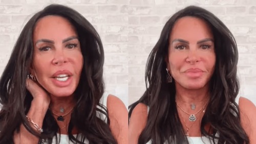Gretchen passa por procedimento feito no clitóris; conheça a capuzplastia