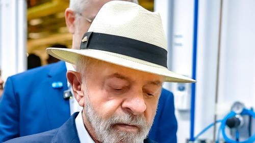Lula passa por sessões preventivas de radioteratia devido à lesão na cabeça