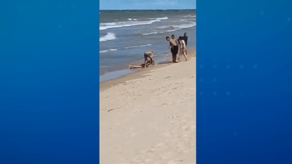 Menino atacado por tubarão na Praia de Piedade (PE) tem perna amputada