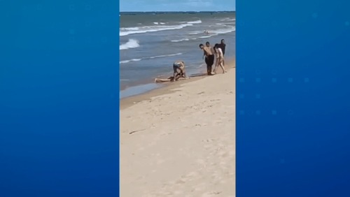 Menino atacado por tubarão na Praia de Piedade (PE) tem perna amputada