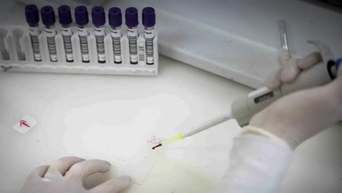 Secretaria de Saúde de SP investiga novo caso suspeito de ebola