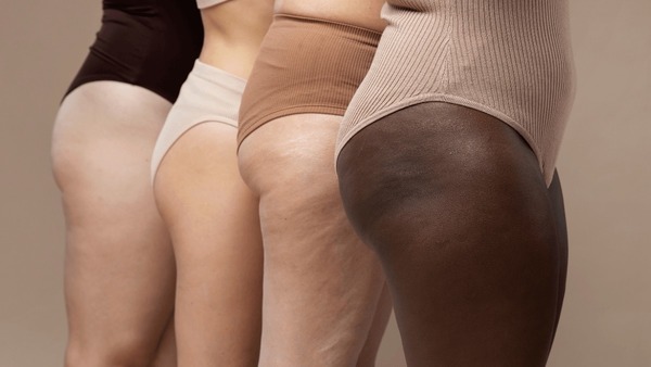 Bumbum de Ozempic: entenda por que ele acontece e como prevenir