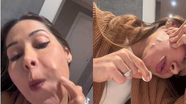 Maíra Cardi expõe problemas após 20 anos de PMMA no rosto: 'Fui enganada'