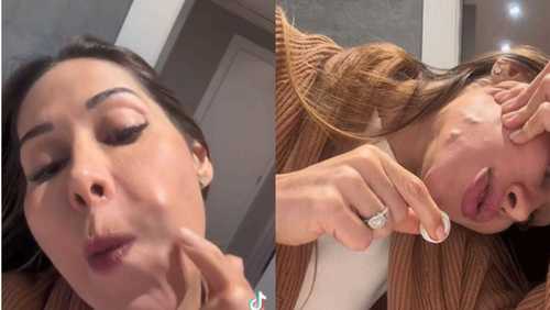 Maíra Cardi expõe problemas após 20 anos de PMMA no rosto: 'Fui enganada'