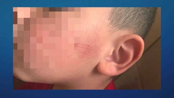 Pais denunciam agressões de professora em escola Militar no RS
