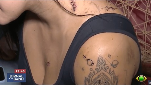 Jovem sobrevive a tentativa de feminicídio após levar 10 facadas