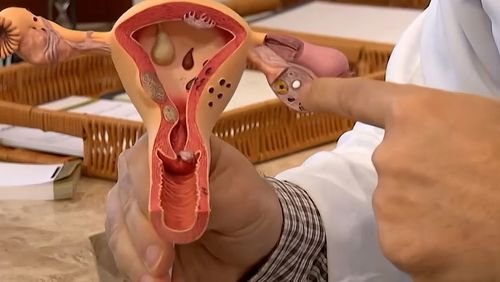 Aberta chamada pública para pesquisas sobre endometriose