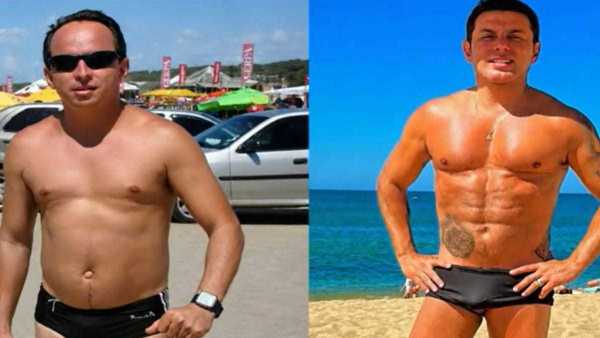 Marido de Gretchen impressiona ao mostrar antes e depois de cirurgias