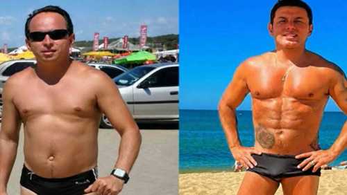 Marido de Gretchen impressiona ao mostrar antes e depois de cirurgias