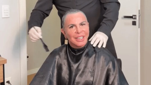 Aos 67 anos, Gretchen raspa a cabeça ao vivo para transplante capilar; veja