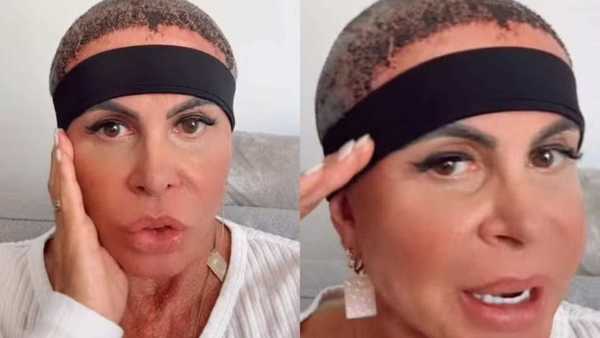 Gretchen mostra recuperação após transplante capilar: 'Estou bem'