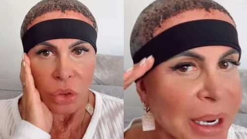 Gretchen mostra recuperação após transplante capilar: 'Estou bem'