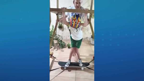 Pai cria skate adaptado para filho com hidrocefalia no ES