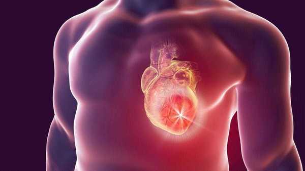 Paulistas infartam até 12 anos mais cedo que o resto do País, mostra estudo