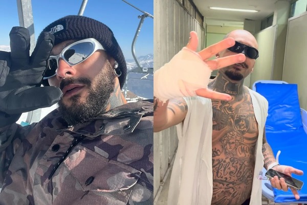 Streamer decide leiloar dedo que perdeu ao tentar invadir Rock in Rio