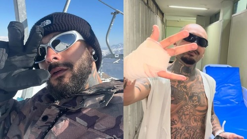 Streamer decide leiloar dedo que perdeu ao tentar invadir Rock in Rio