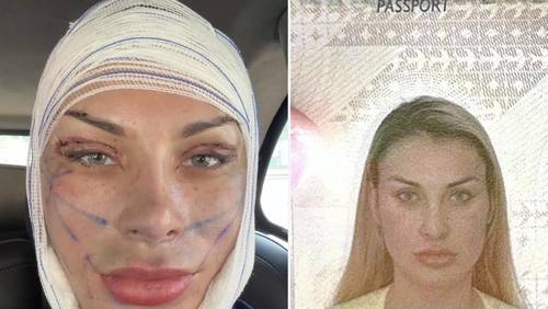 Andressa Urach passa por perrengue com biometria facial após cirurgias