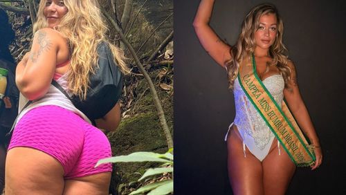 Miss Bumbum 2026 diz ter descoberto lipedema em trilha: 'Susto'