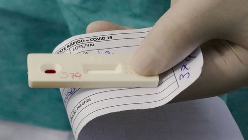 SP está fazendo 8 mil testes para diagnóstico de coronavírus por dia