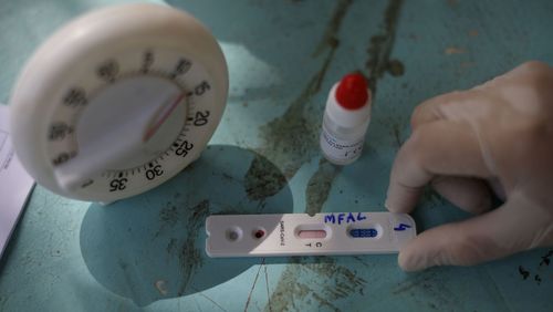 São Paulo tem 202.967 mil pessoas recuperadas de covid-19