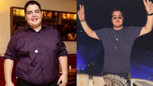 Novo visual de filho do Faustão após cirurgia bariátrica impressiona